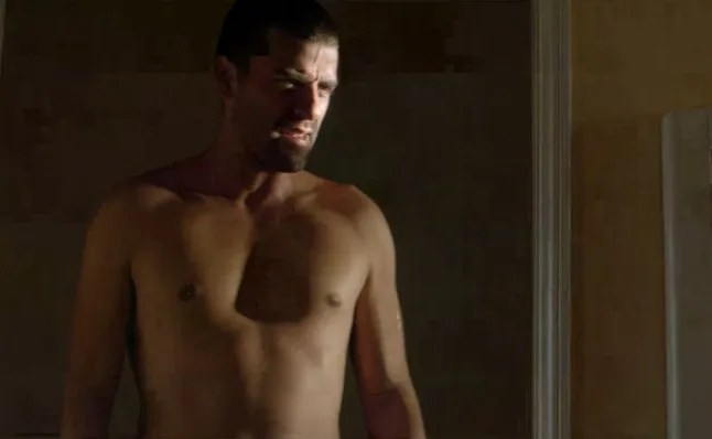 Oscar Isaac Pectus Excavatum